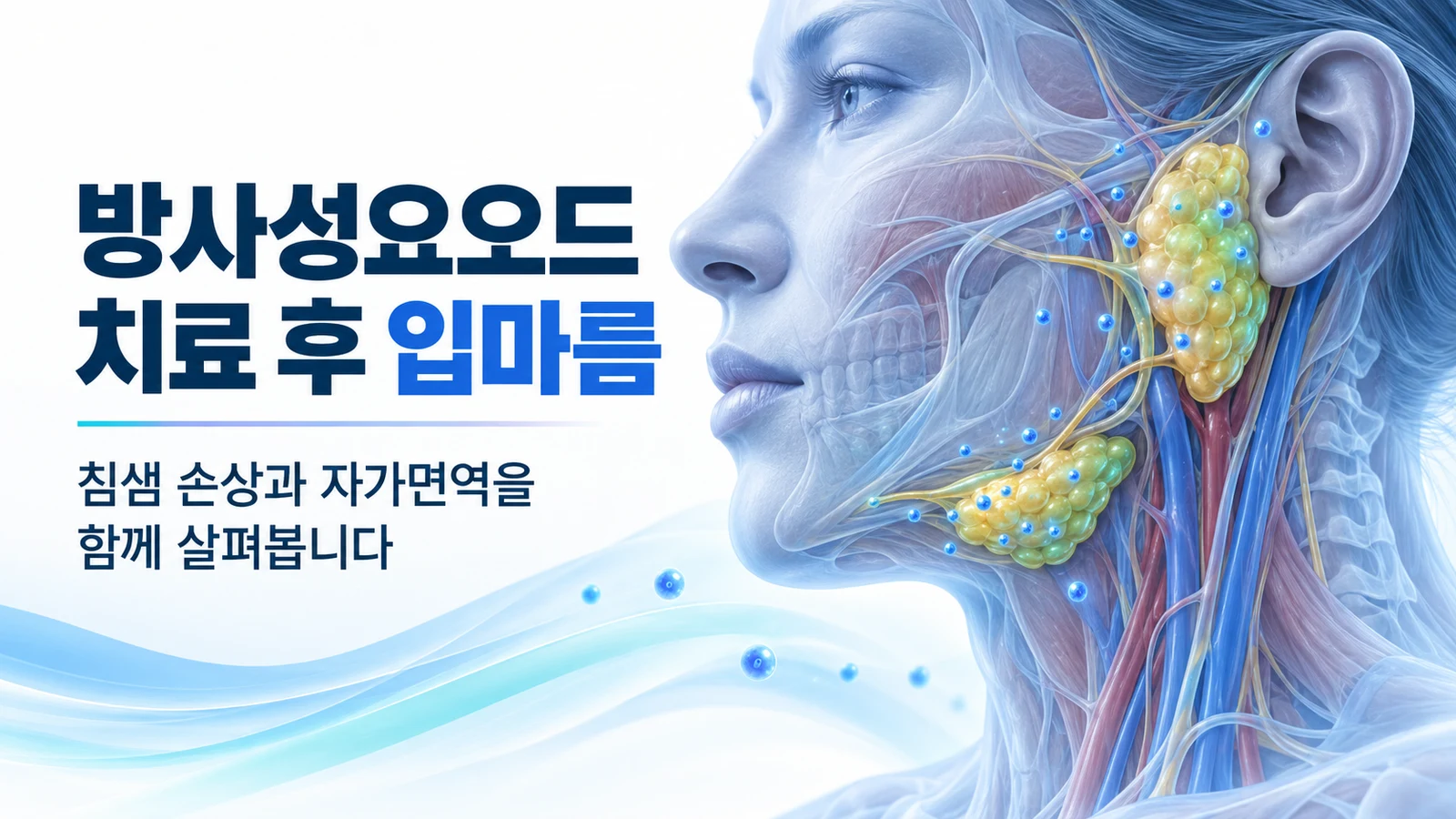 방사성요오드 치료 후 입마름을 일으킬 수 있는 귀밑샘과 턱밑샘의 위치를 보여주는 설명 그림
