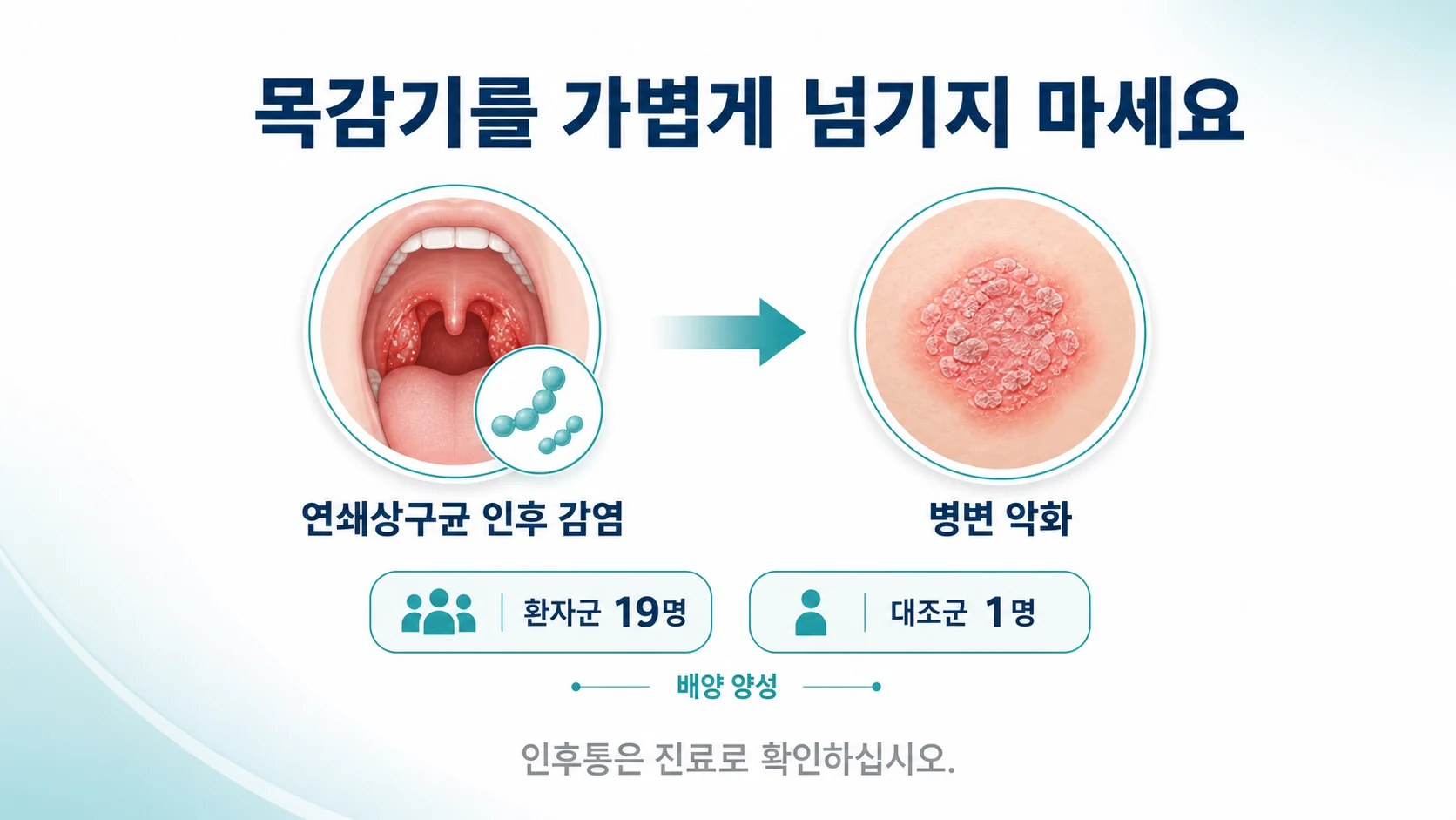 목의 연쇄상구균 감염이 건선 악화의 트리거가 될 수 있음을 설명하는 이미지