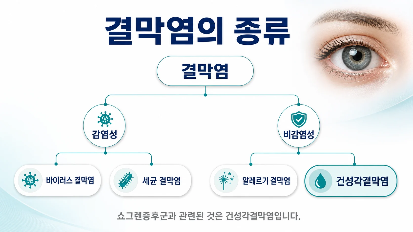 결막염이 감염성인 바이러스 세균 결막염과 비감염성인 알레르기 결막염 건성각결막염으로 나뉨을 보여주는 분류 이미지