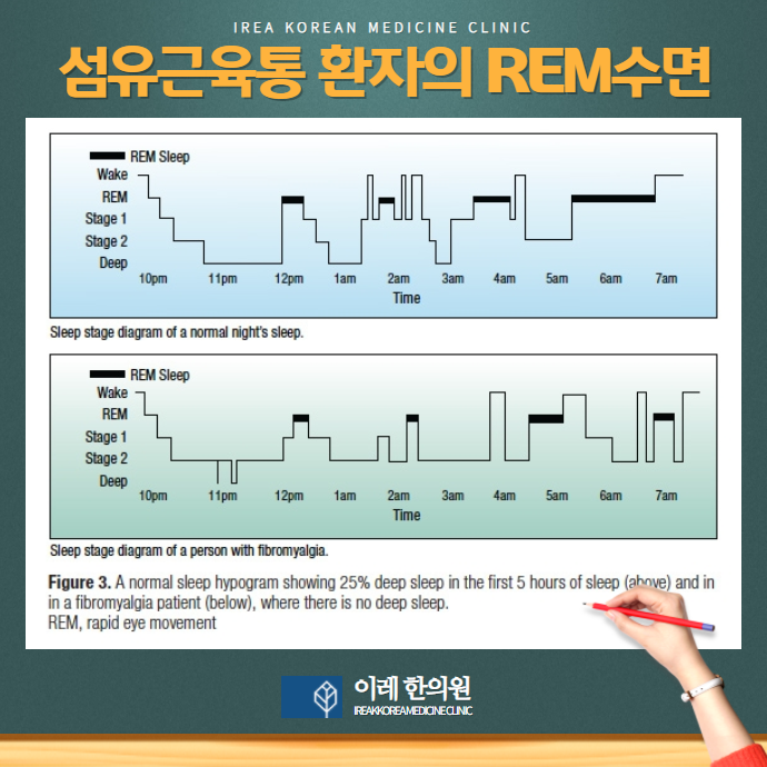 이미지 2