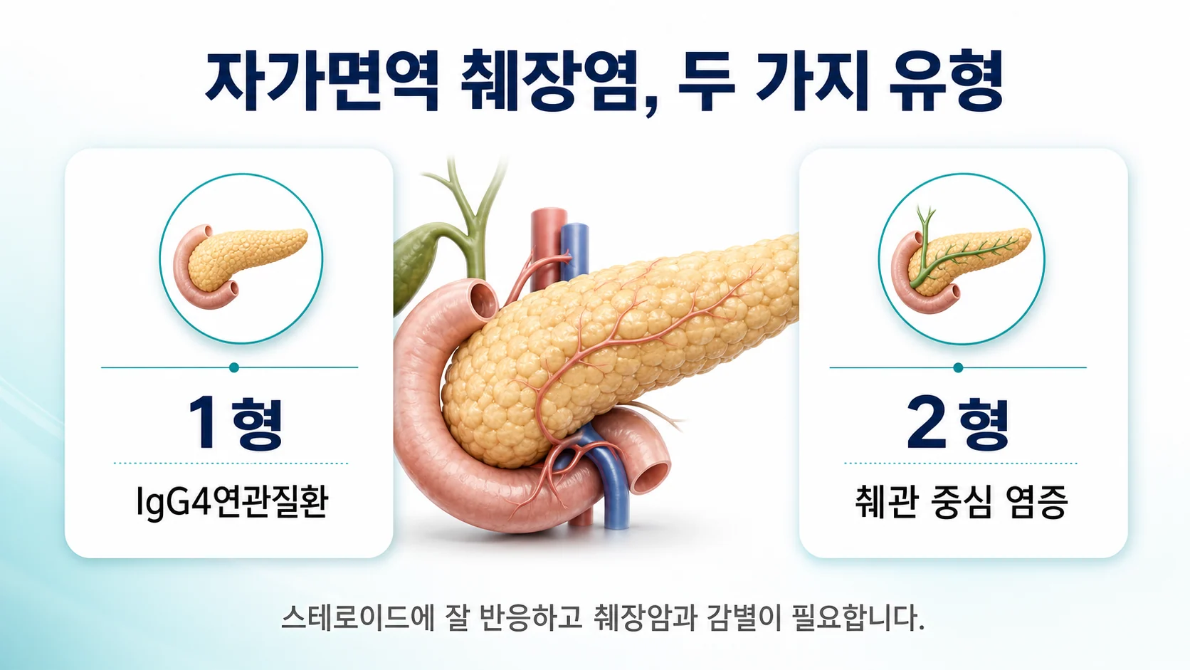 자가면역 췌장염 1형은 IgG4연관질환의 증상이며 진짜 쇼그렌증후군과 구분해야 함을 설명하는 이미지