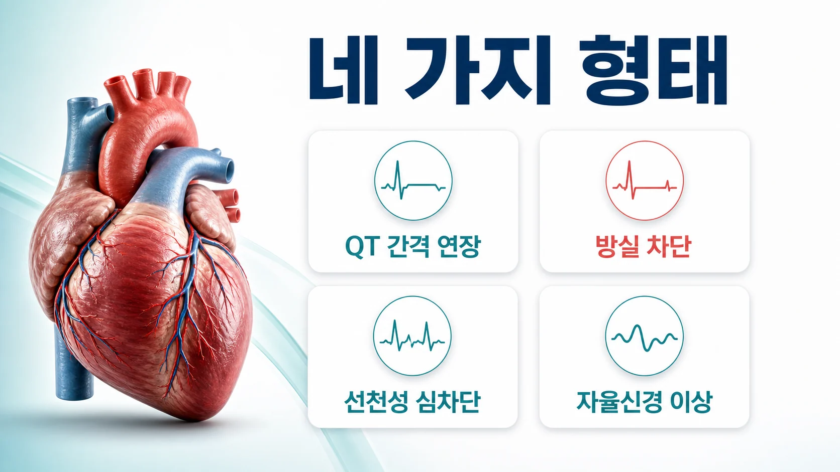 쇼그렌증후군에서 나타나는 부정맥의 네 가지 형태를 정리한 그림