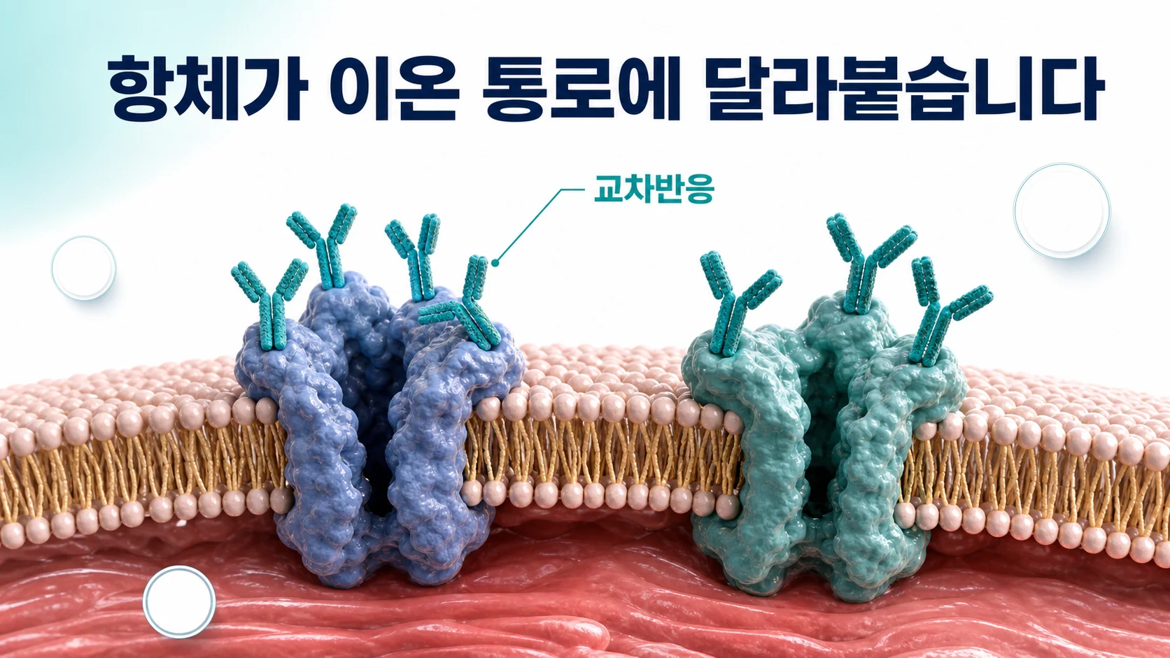 자가항체가 심장 세포막의 이온 통로에 결합해 리듬을 흔드는 과정을 표현한 그림