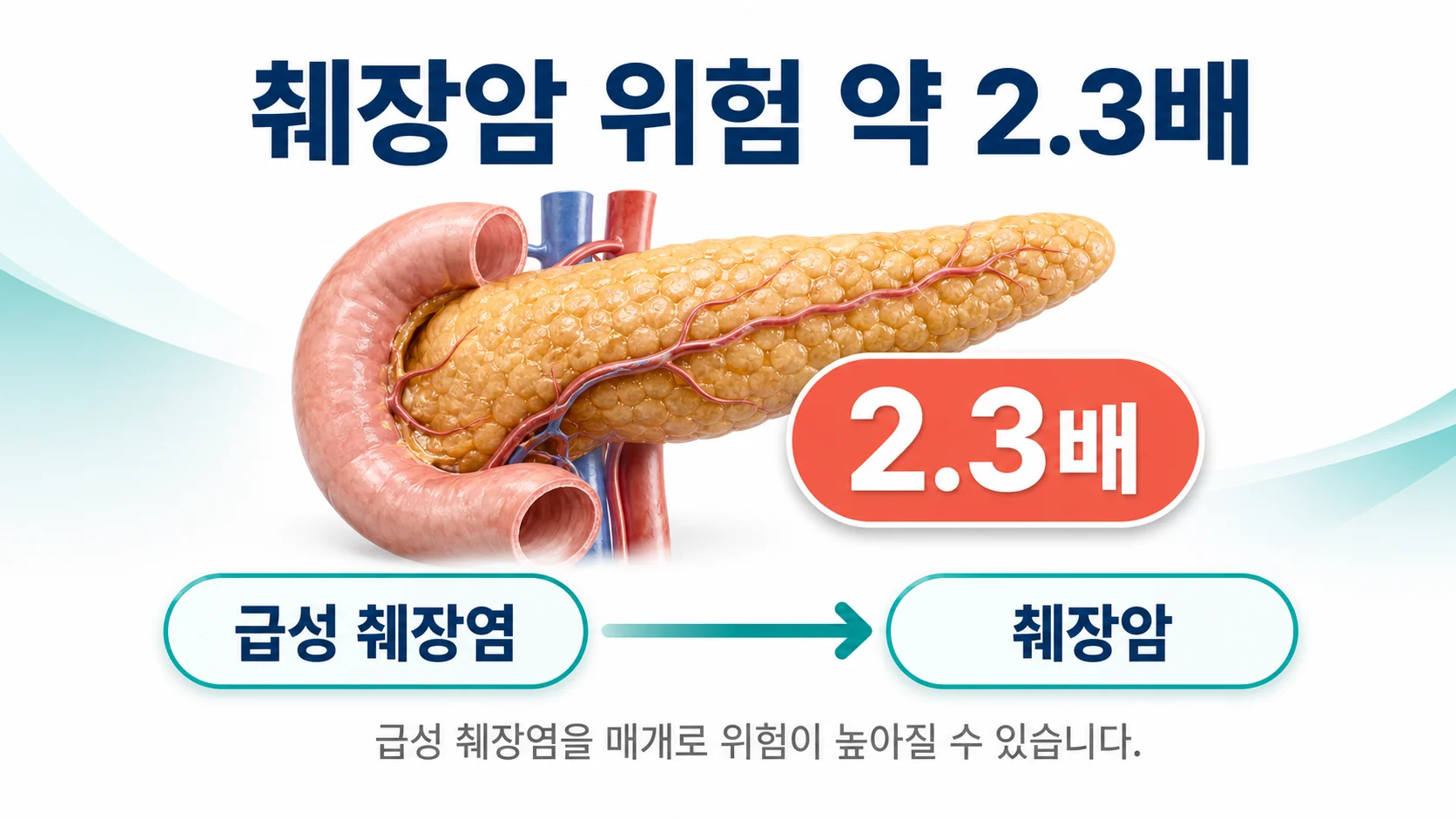 쇼그렌에서 췌장암 위험이 약 2.3배 높고 급성 췌장염을 매개로 할 수 있음을 설명하는 이미지