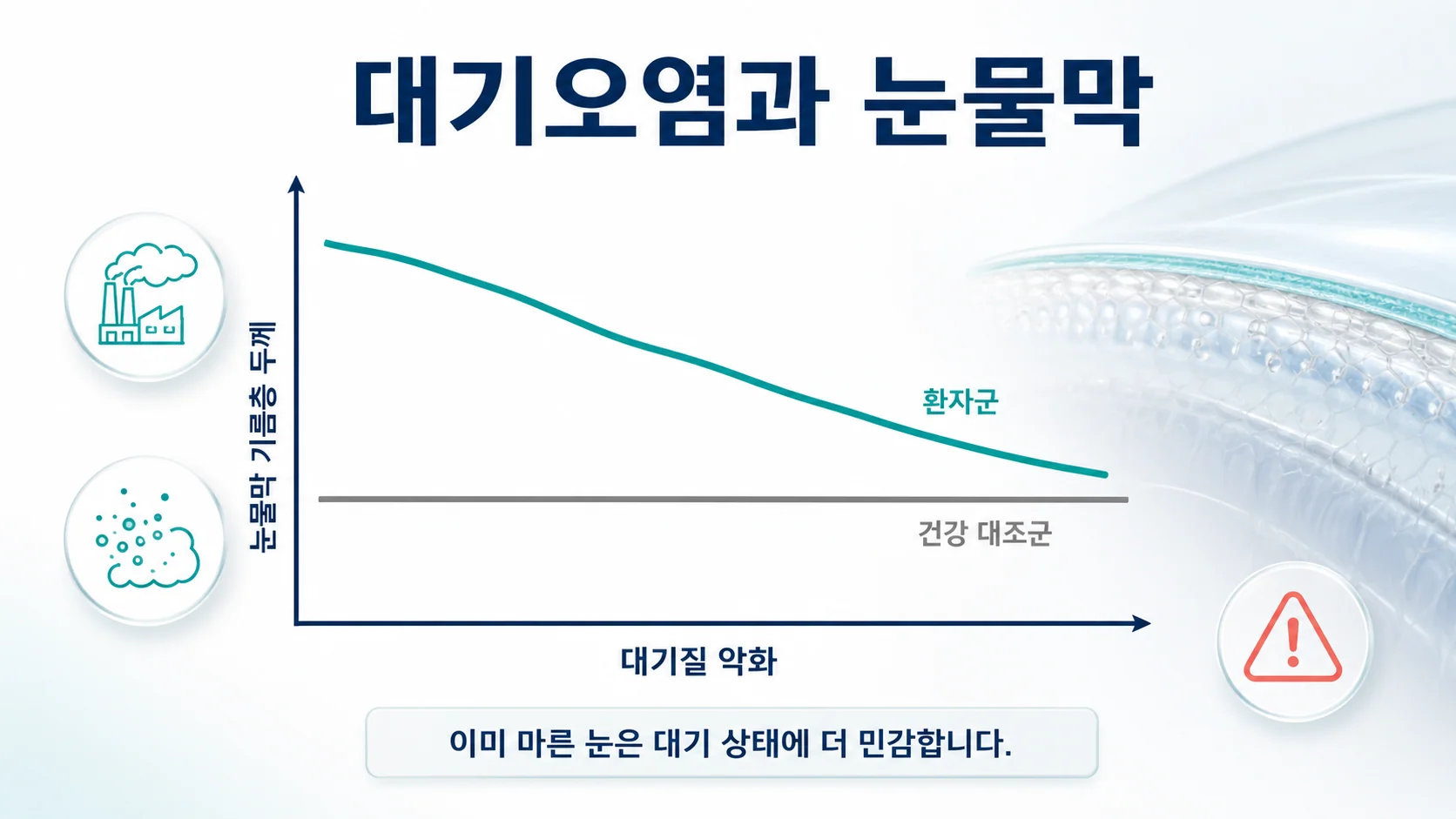 대기오염과 미세먼지가 쇼그렌 환자의 눈물막 지질층을 얇게 만들어 충혈을 악화시킴을 설명하는 이미지