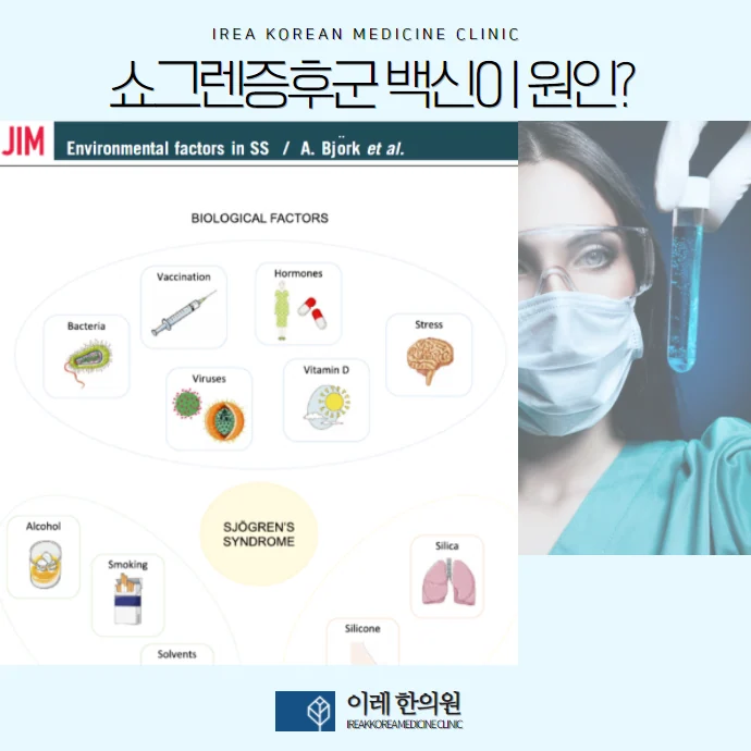 쇼그렌증후군 예방접종vaccine 어떻게 해야 할까 #2