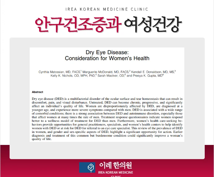 안구건조증과 여성 건강 자가면역질환과의 관련성 #2