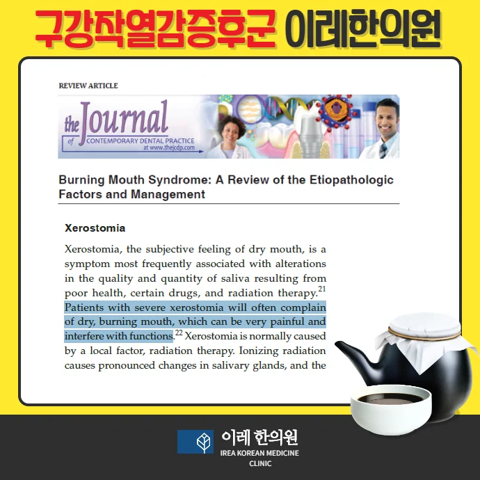 혀통증 , 건조증이 먼저 발생할 수 있습니다. - img_02
