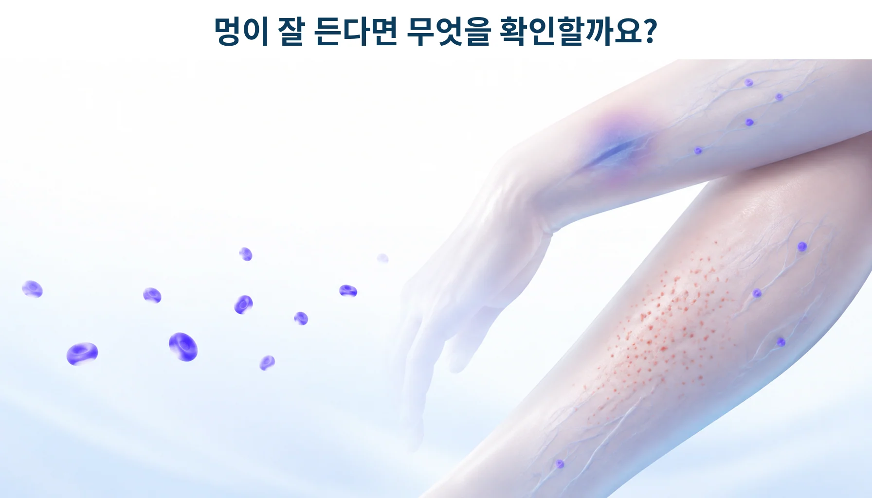 혈소판이 줄어들 때 피부에 나타나는 변화를 형상화한 개념 그림