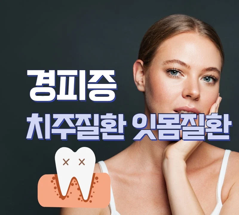 경피증 증상 중 잇몸 문제와 치주 질환은 어느정도일까 #1