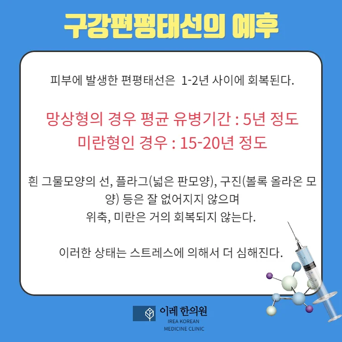 구강 편평태선 얼마나 오래 지속될까요 #2