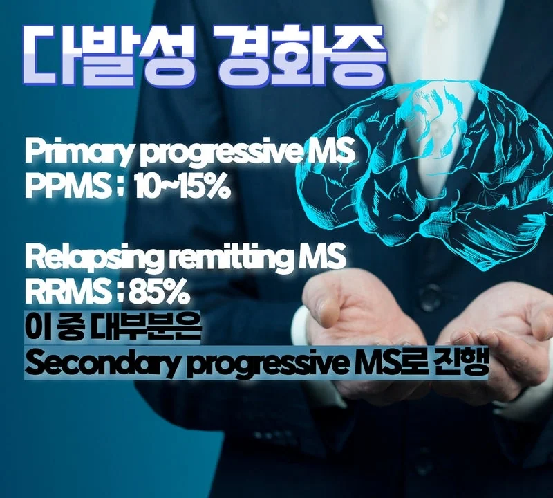 다발성 경화증 종류와 예후는 #4