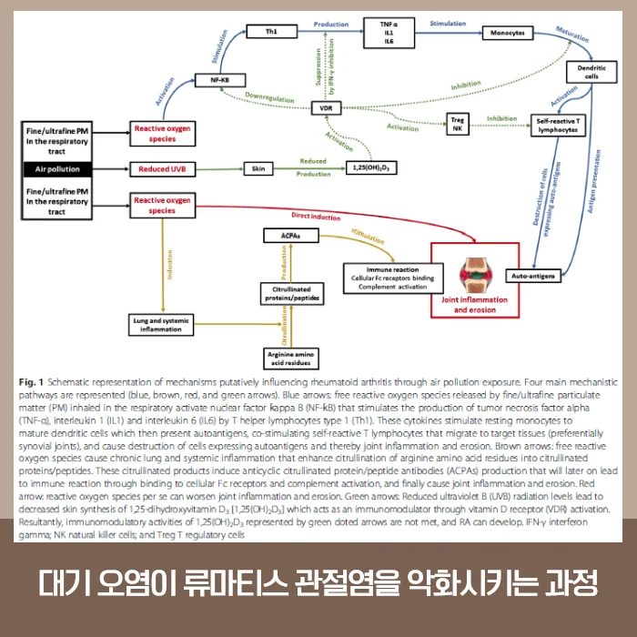 류마티스 관절염 #2