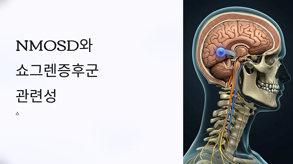 시신경척수염과 anti #1