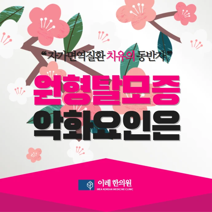 원형탈모 흡연이 원인이 될까요 #2