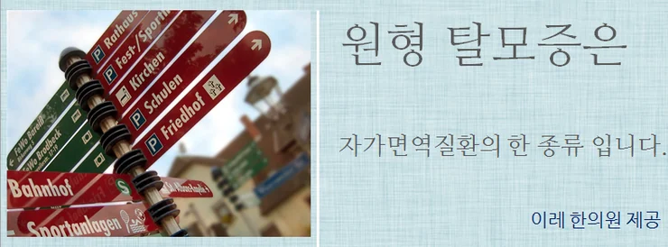 인천 원형탈모와 자가면역질환의 연관성을 설명하는 대표 이미지