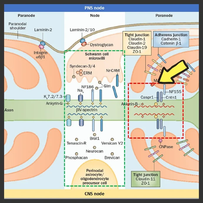 자가면역 결절병증 autoimmune nodopath #4