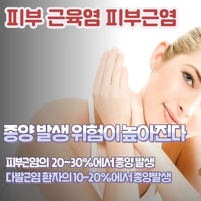 피부근염 다발성근염에 대한 한의학 치료 경과는 #2