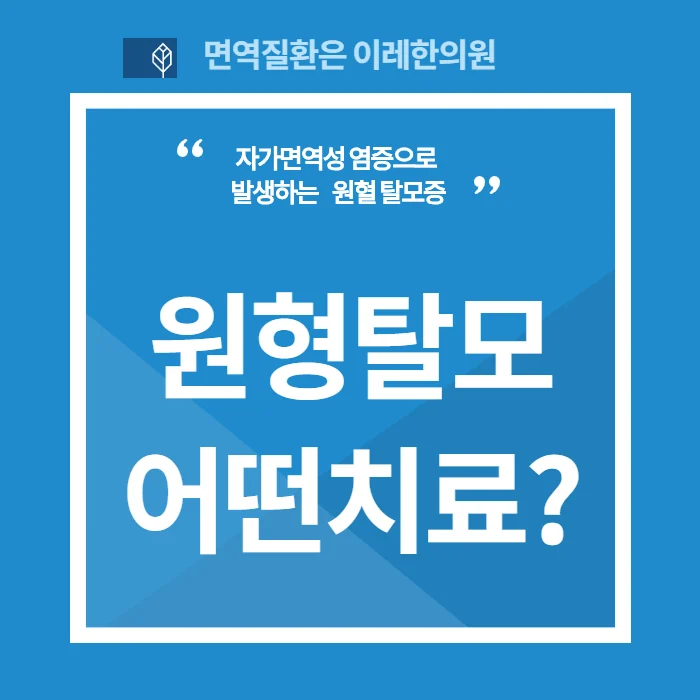 인천 원형탈모 치료 약의 종류와 한계
