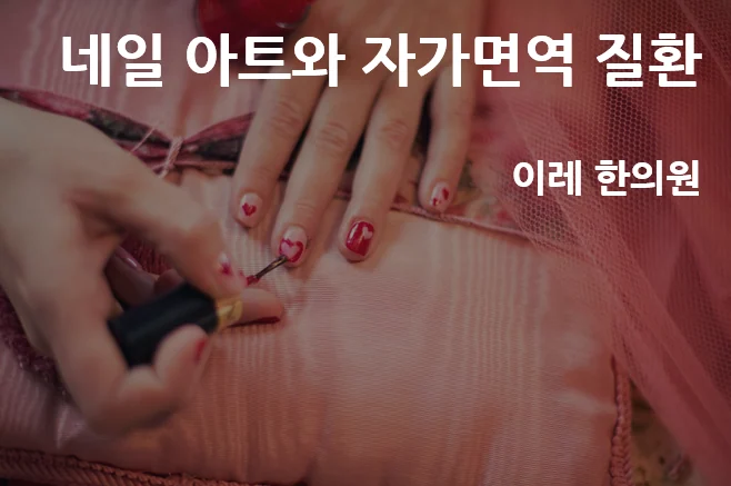 자가면역질환과 매니큐어
