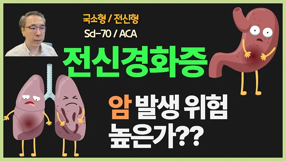 전신경화증 암 발생 위험도는 얼마나 될까요?