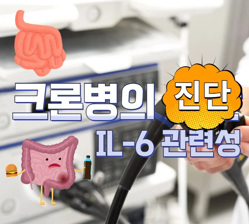 크론병(Crohn's disease, CD) 진단과 IL-6와의 관련성은 어느 정도
