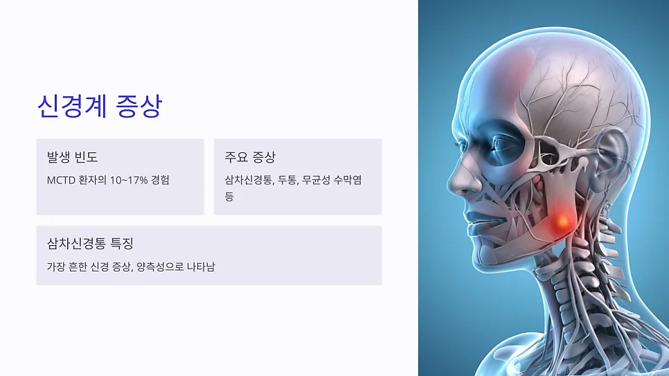 혼합결합조직병 증상 중 삼차신경통