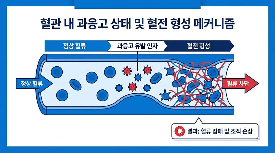 항인지질항체증후군 증상 습관성 유산을 제외한 전신 #3