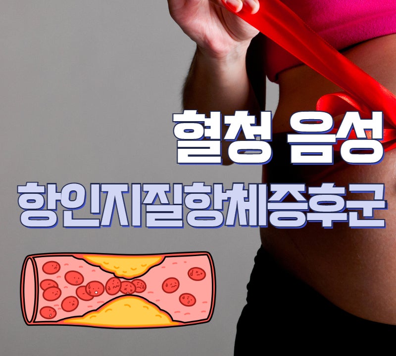 이미지 1