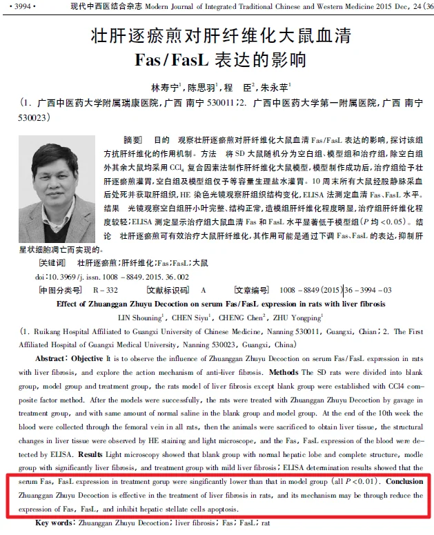 간섬유증 모델 한약 투여군의 Fas/FasL 측정