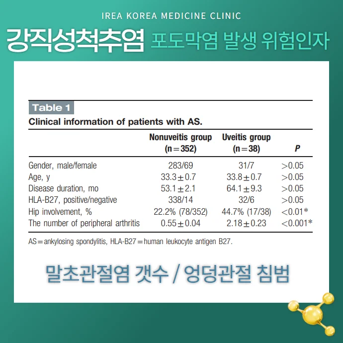 강직성 척추염 척추관절염에 나타나는 포도막염의 증상 예 #3