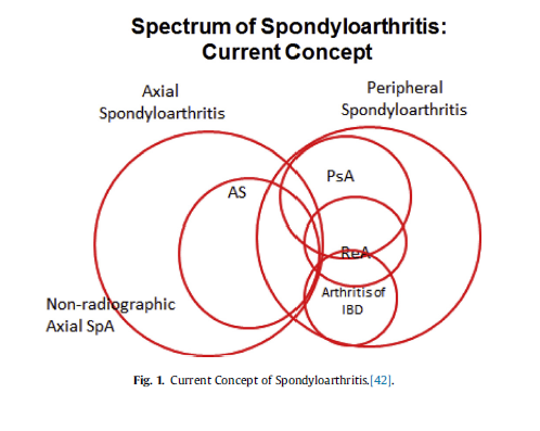 척추관절염spondyloarthritis, SpA #2