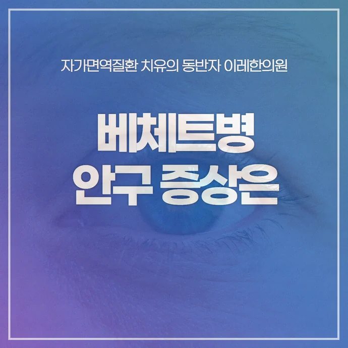 베체트병 증상 - 눈에 발생하는 안구 안과 질환은