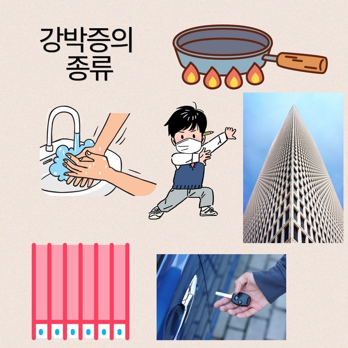 강박증과 혀통증의 관계 - 구강작열감증후군에 동반되는 심리적 요인 - img 02