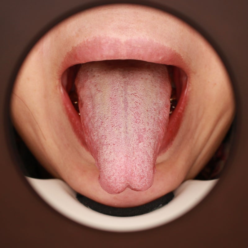 유병률 비교표