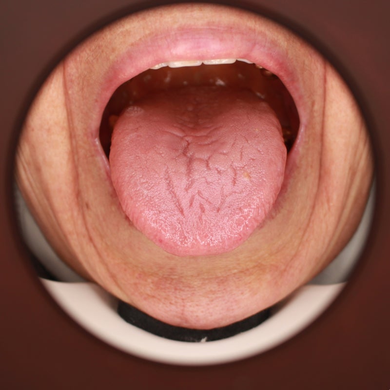 치료의 딜레마