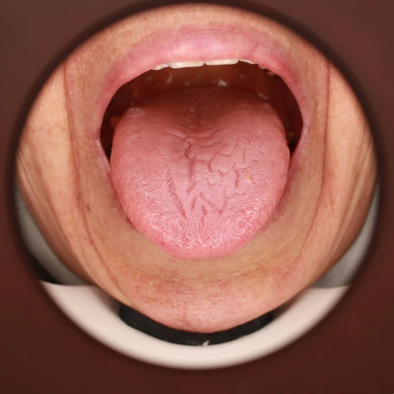 치료의 딜레마