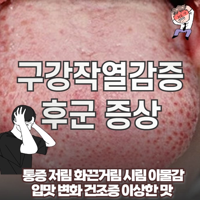 구강작열감증후군 증상