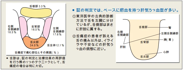 구강작열감 작열감이 나타나는 부위 분포