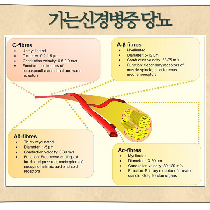 당뇨병이 혀통증과 구강작열감증후군의 원인이 되는 이유 - img 02