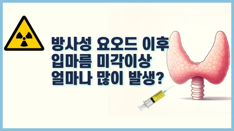 방사성요오드 치료