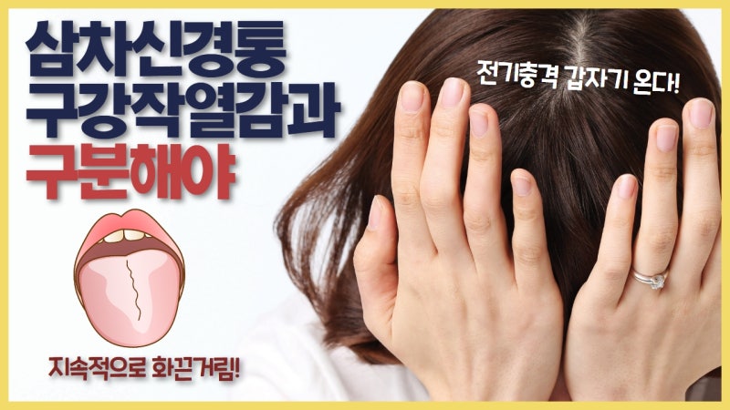 삼차신경통과 BMS 구분