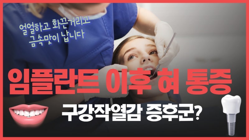 임플란트 후 혀 통증