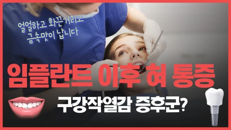 임플란트 후 혀 통증