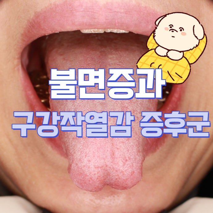 혀 따가움과 불면증