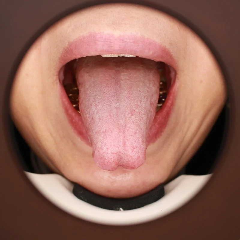염증성 사이토카인 경로