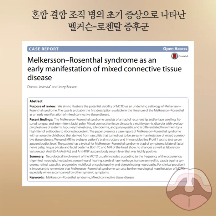 혀가 갈라지는 원인 - 멜커슨-로젠탈 증후군과 자가면역질환의 관계 - img 03