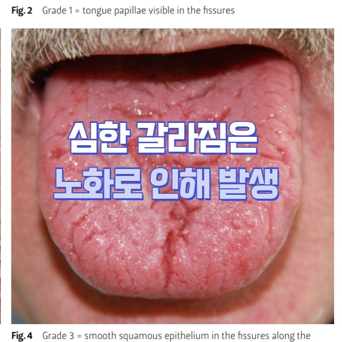 균열설 관리