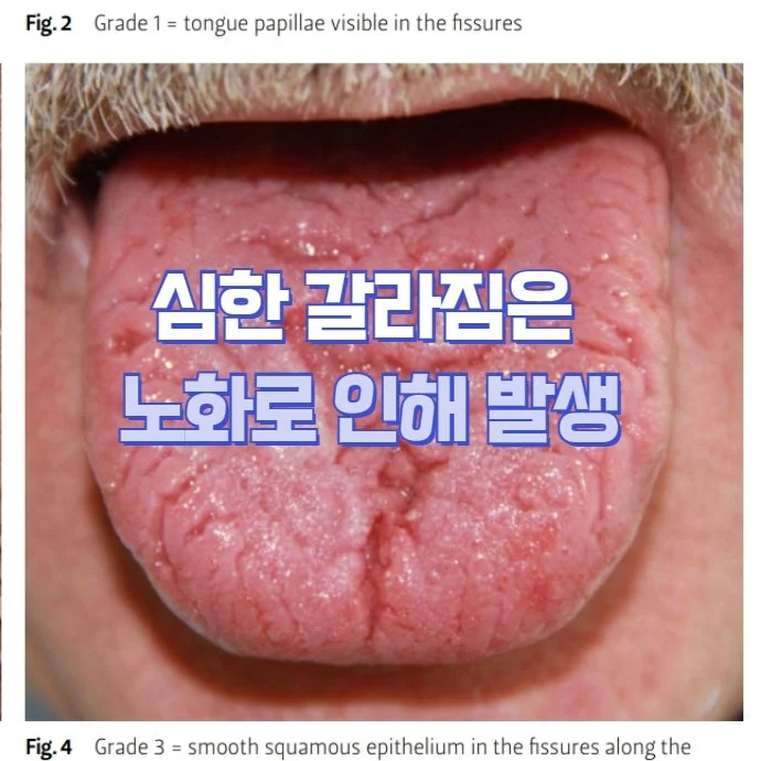 균열설 관리