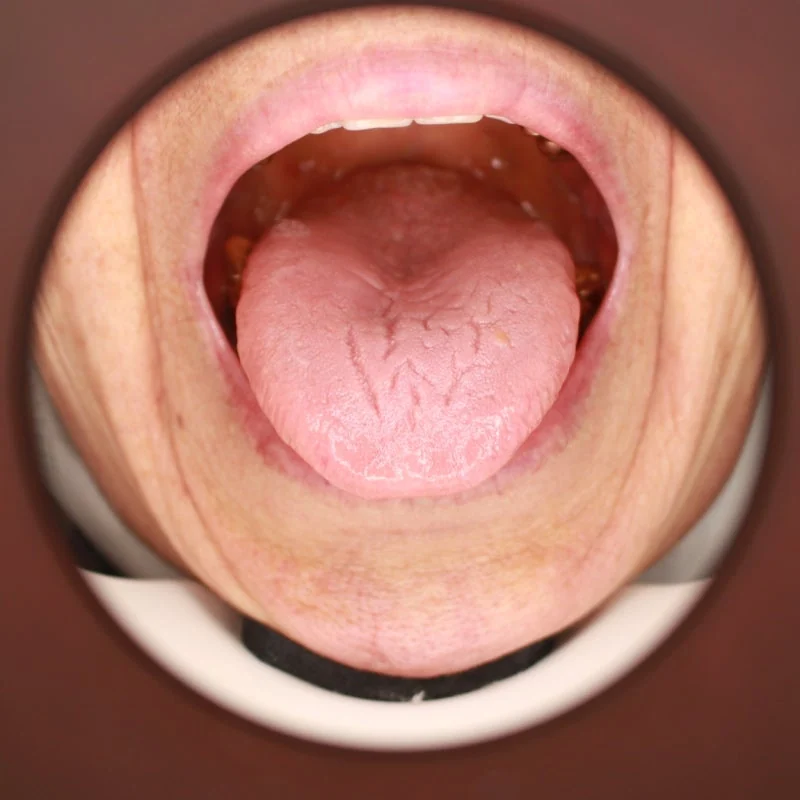 한의학 치료